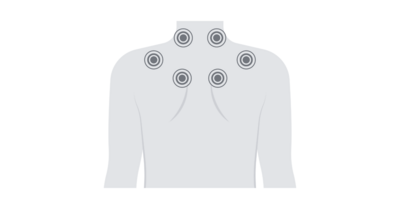 Instrument-Assisted Soft Tissue Manipulation
