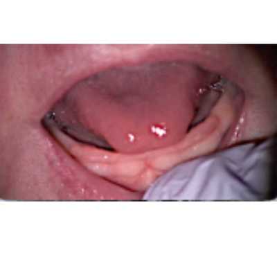 Unnamed Image